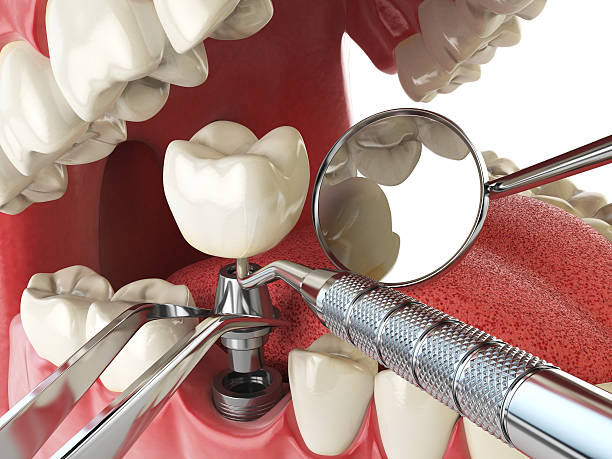 Best Emergency Gum Treatment in Greenwich, OH